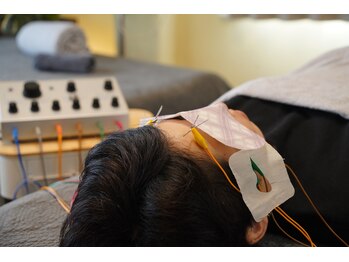 あかり鍼灸接骨院/電気を流す美容鍼【目力美鍼】