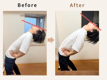 ハリデイズ/40代-繰り返す腰痛