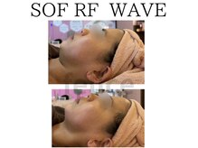 アイリー(IRIE)/ソフアールエフウェーブ