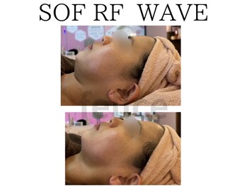 アイリー(IRIE)/ソフアールエフウェーブ