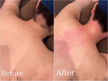 ジョエルワックス 沖縄那覇店(JOELLE WAX)/背面美人に♪うなじ&背中ダブル