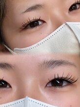 サンティエ(scintiller)/LCカール