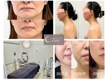 エイジングケアサロンシー(aging care salon cee)の雰囲気(身体も整えるから根本たるみ改善につながります。)