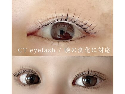 シーティー(CT)の写真
