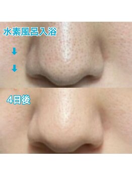 リリー オブ ザ バレー(lily of the valley)/