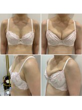 トロイカ(troika)/バストアップ　6回での効果★