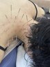 "頑固なコリ"首肩・腰痛の辛さの方へ！【オーダーメイド施術★ルート鍼30分】