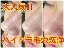 ハナン(Hanan)の雰囲気（黒ずみ・毛穴開きにハイドラ毛穴洗浄!!肌質改善・トーンアップ◎）