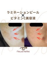 フルーヴ ルフレ(Fleuve Reflet)/ピーリングとビタミンの相乗効果