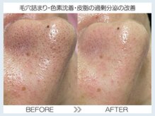 フェアリー(fairy)/