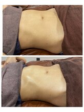 エスエー(SA)/肩こりが酷い方