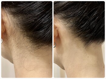 朝と詩/Before→After