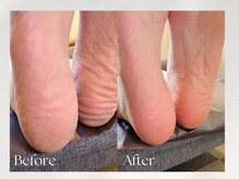 レイネイル(Lei nail)の雰囲気(ふわふわ角質フットケア(マグネット/フィルイン/フットネイル))