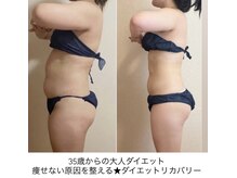 リュミエール(umiere)