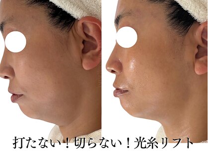 ボディメイキング キキ(Bodymaking KIKI)の写真