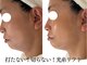 ボディメイキング キキ(Bodymaking KIKI)の写真
