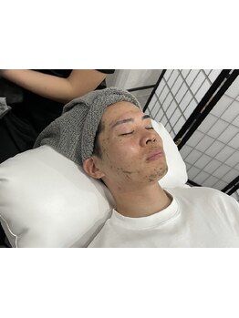 メンズフェイシャル