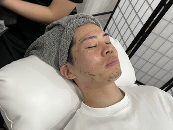 サムライビューティー 渋谷東店(SamuraiBeauty)の写真/【渋谷/メンズ専門サロン】今話題のハーブピーリングで男磨き！肌悩みを改善し、お顔の第一印象グンとUP！