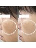 【バレンタインクーポン】透明感のあるお肌になりたい方/くすみケア 90分