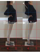 ヨギート(yogate)/リンパ/骨盤矯正/ヘッドスパ小顔