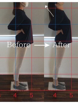 ヨギート(yogate)/リンパ/骨盤矯正/ヘッドスパ小顔