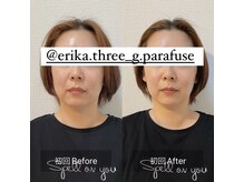 スリージー/before／after