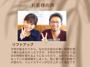 健美庵/リフトアップに美容鍼