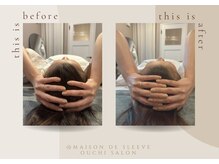 メゾンドスリーブ(Maison de Sleeve)/BeforeAfter