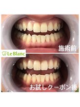 ルブラン 奈良店(Le Blanc)/土日祝ご利用のお客様