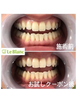 ルブラン 奈良店(Le Blanc)/土日祝ご利用のお客様