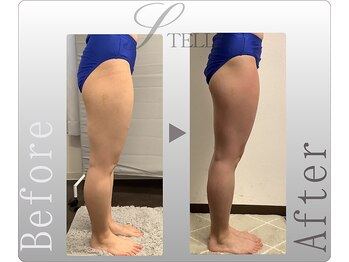 ステラ(STELLA)/下半身スタンダードの効果