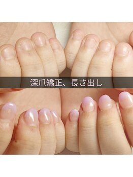 マニエネイル(mani e nail)/深爪矯正ネイルで生まれ変わる