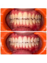 コナホワイトニング 神保町/ホワイトニング