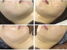 リラーナ(Re rana)