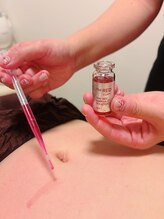 フォトビズ/レッドショットでお腹の脂肪分解