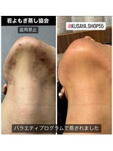 リレフー(Relafy)/★美肌★30代　女性　