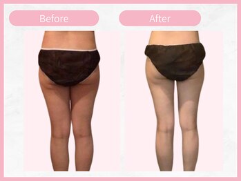 アールエイチビー 藤沢店(RHB)/