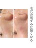 15名限定！【黒ずみ・角栓除去に】つるんと毛穴洗浄フェイシル