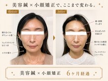 カドモリ 心斎橋(KADOMORI)の雰囲気（美容鍼/大阪美容鍼/心斎橋美容鍼/本町美容鍼/四ツ橋/小顔矯正）