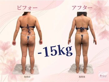 セラピアの写真/今すぐ始める《燃焼×引き締め》新感覚キャビラジで、気になる部分を集中ケア◎憧れのメリハリ美ボディへ