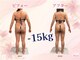 セラピアの写真/今すぐ始める《燃焼×引き締め》新感覚キャビラジで、気になる部分を集中ケア◎憧れのメリハリ美ボディへ