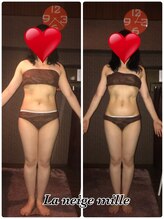 ラネージュミル(La neige mille)/インキュア痩身