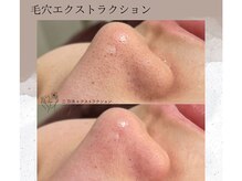 ベルーテ 田町三田(Bellute)/黒ずみ、つまりリセット★