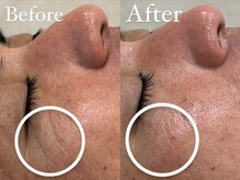 ザ パールズ(The Pearls)/なんとシワの改善も！