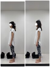 ラフテル鍼灸整骨院/反り腰改善に整体×ピラティス
