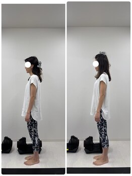 ラフテル鍼灸整骨院/反り腰改善に整体×ピラティス