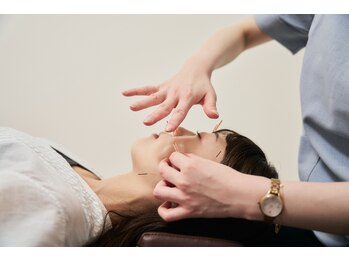 ハリナチュレ 札幌店/エラ張り特化美容鍼