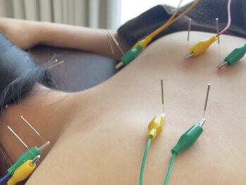 鍼灸 整体院 スズユ(SUZUYU)の写真/【鍼灸整体×ストレッチ】首肩こり/腰痛お悩みを最短ルートで解消◎動きの癖を見極め、生活習慣から改善◇