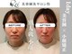 怜(Rei)の写真