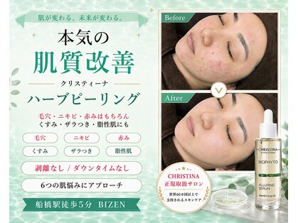 ビゼン(BIZEN)の写真